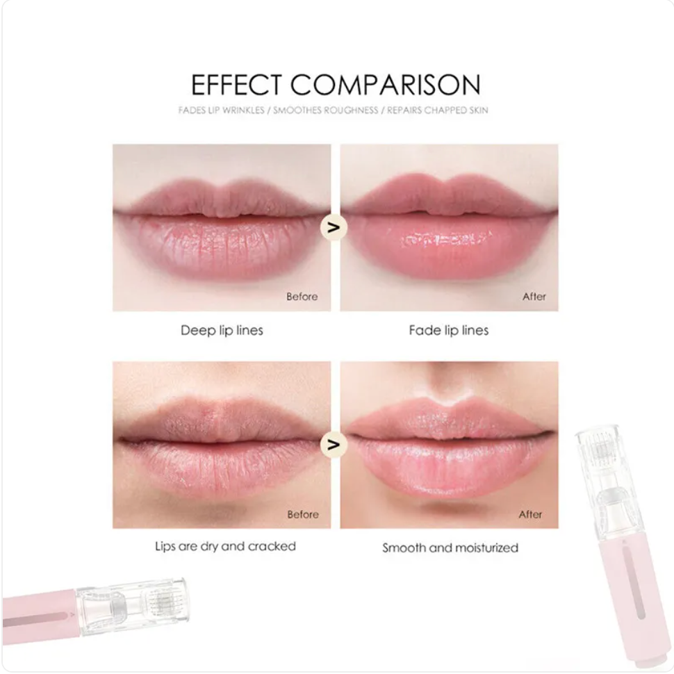 Compact Lip Enhancer Roller